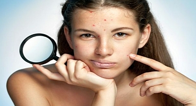  Dikkat! Bu hatalar akneleri tetikliyor!