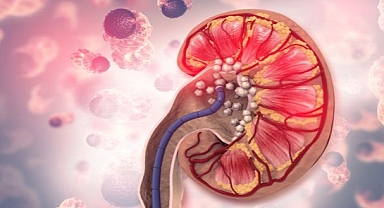 BÖBREK TAŞINA YOL AÇAN 8 ÖNEMLİ HATA!