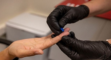 Büyükşehir’den kimliksiz ve ücretsiz test hizmeti