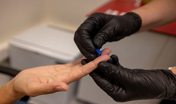 Büyükşehir’den kimliksiz ve ücretsiz test hizmeti